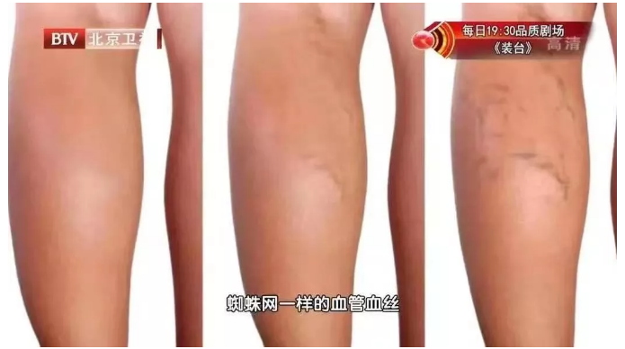 60bf30f98de5d.png image.png