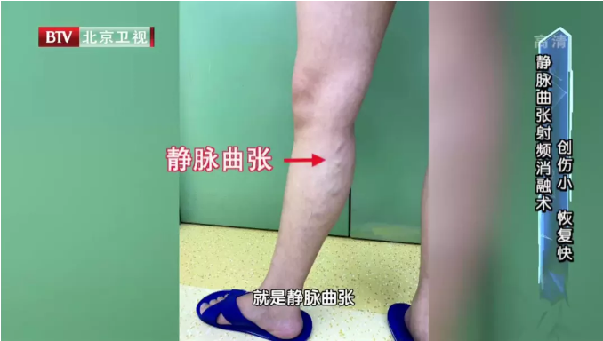 60bf311534fce.png image.png