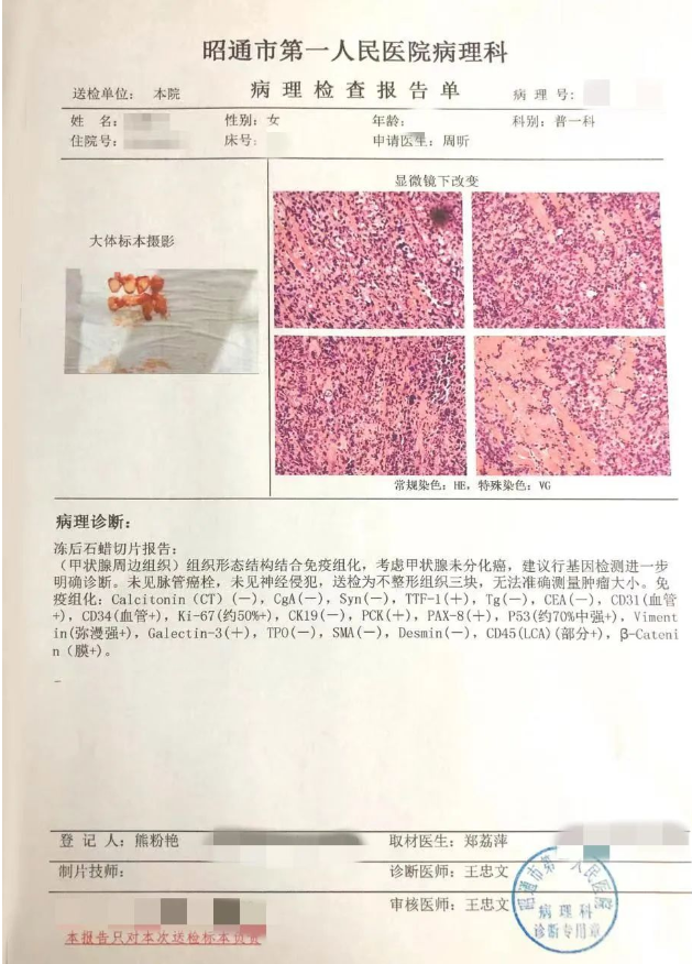 62e8813b71693.png image.png