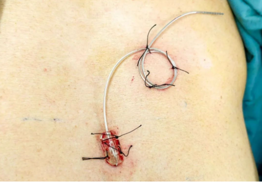 649806a93db0f.png image.png