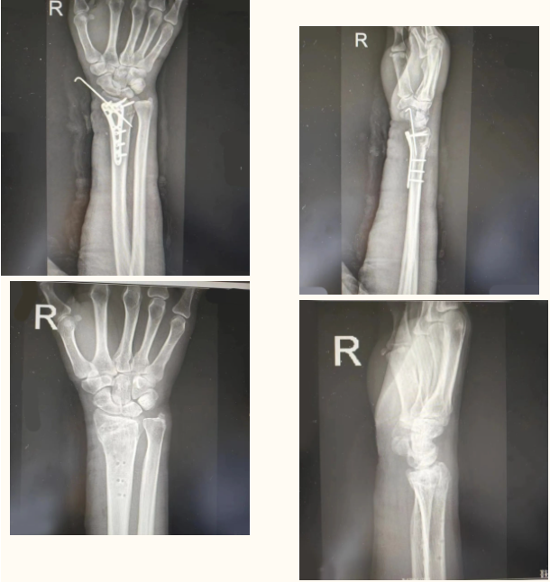 64aa88edc0158.png image.png