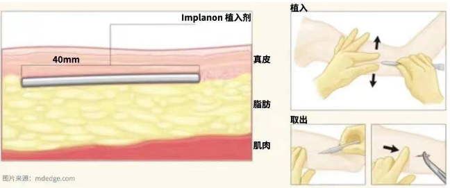 64e70416c9d02.png image.png